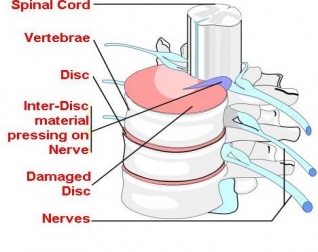 Osteopathic Health Solutions Rozelle Osteopath Balmain Inner West Sydney Osteopathy Back And Neck Pain